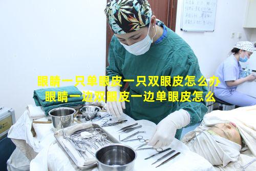 眼睛一只单眼皮一只双眼皮怎么办 眼睛一边双眼皮一边单眼皮怎么办